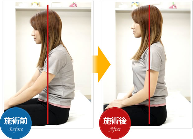 施術前 施術後