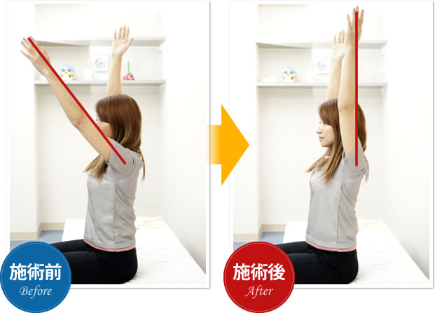 施術前 施術後